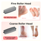 BarberBoss Rechargeable Electric Foot File