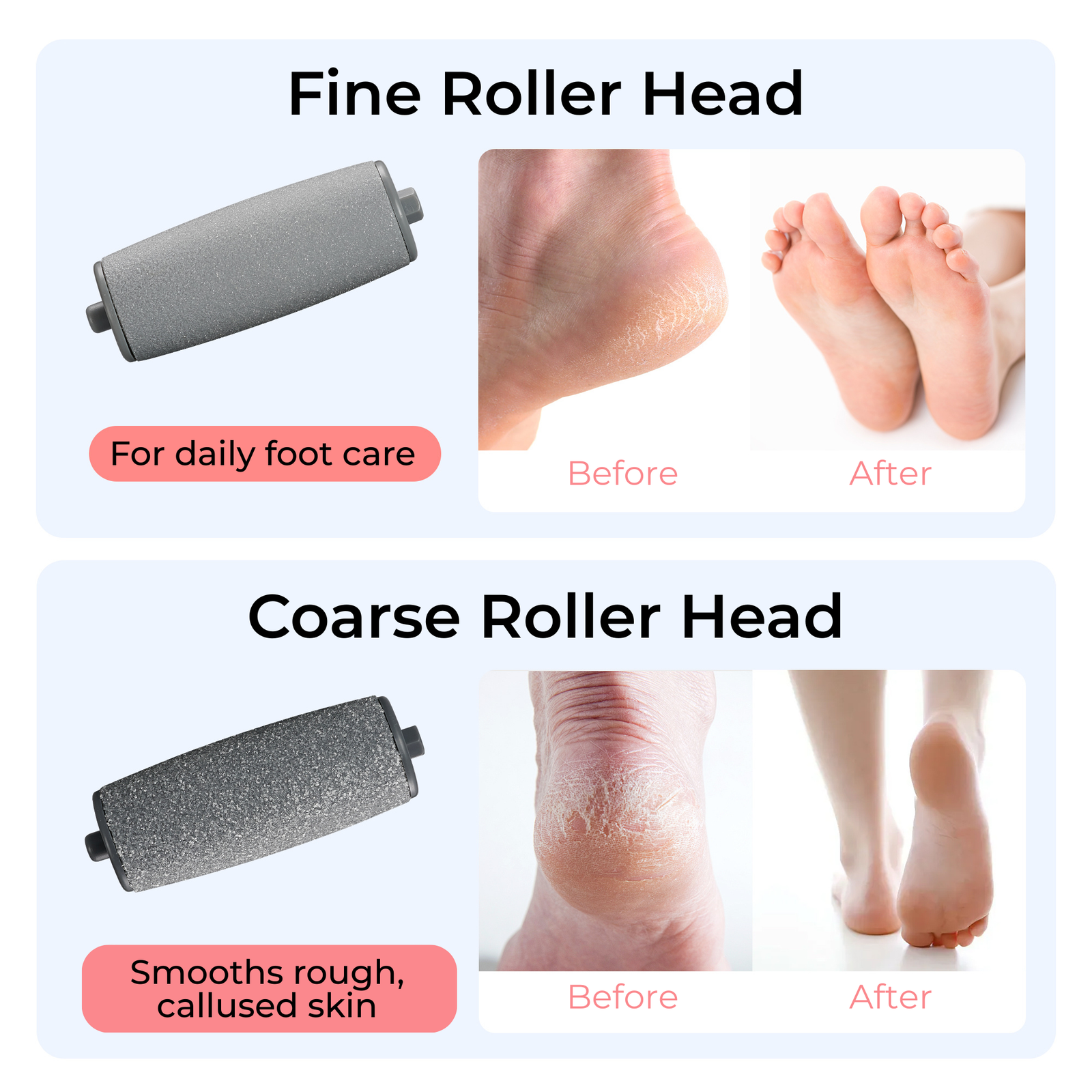 BarberBoss Electric Callus Remover & Pedicure Kit