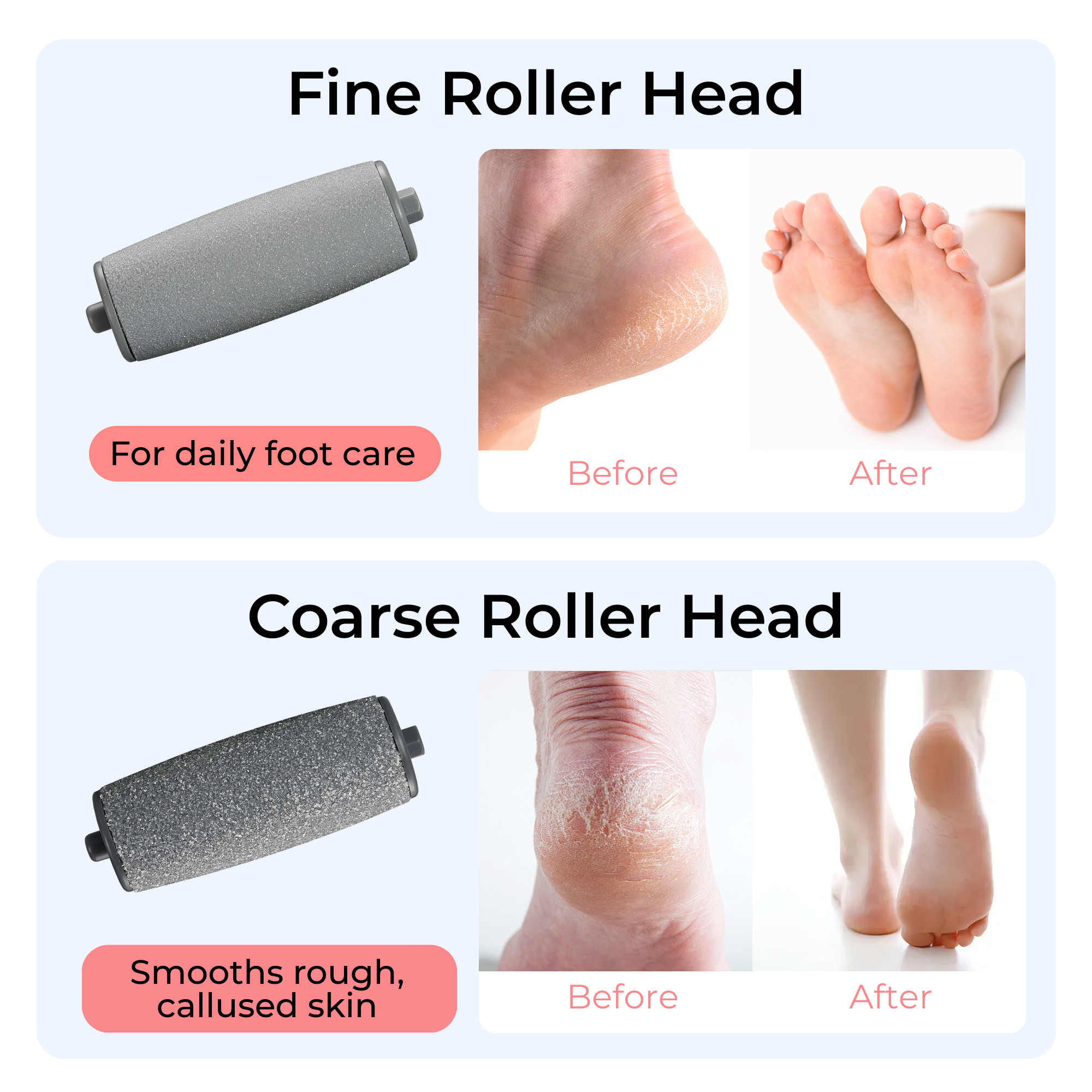 BarberBoss Electric Callus Remover & Pedicure Kit