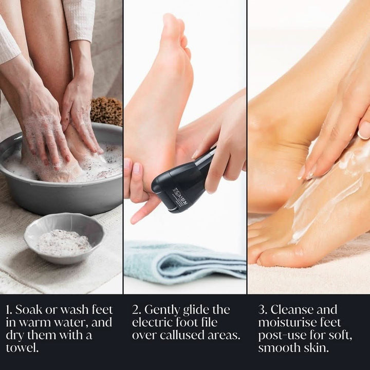 BarberBoss QR - 5081 Electric Foot File Hard Skin Remover - Premium Callus Remover - BarberBoss | Look Your Best, Everyday
