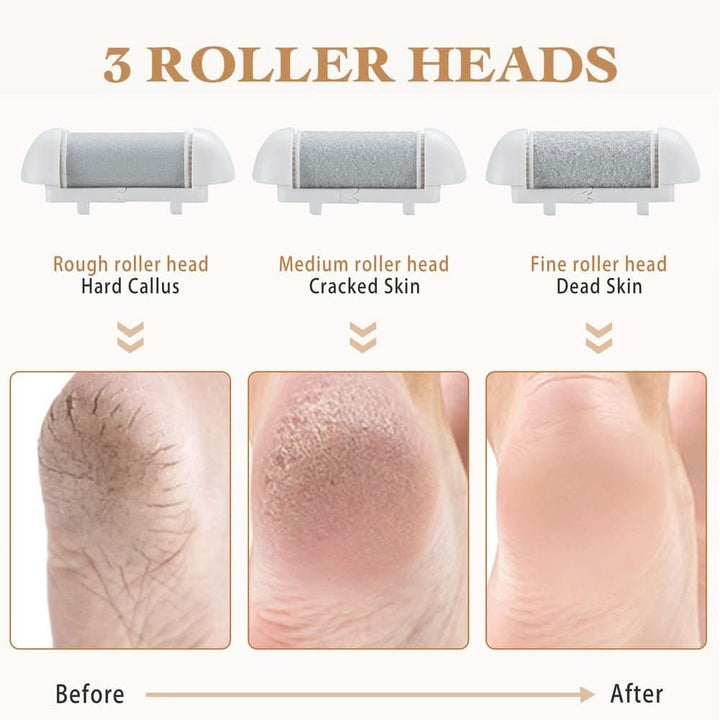 BarberBoss QR - 5082 Electric Foot File Hard Skin Remover - Professional Pedicure - BarberBoss | Look Your Best, Everyday