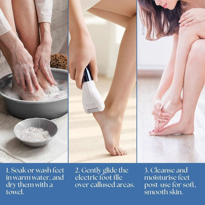BarberBoss QR - 5085 All - in - One Pedicure Set Hard Skin Remover - BarberBoss | Look Your Best, Everyday