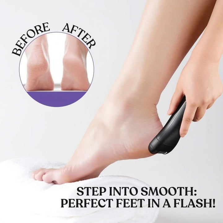 BarberBoss QR - 5086 Electric Foot File Hard Skin Remover - Callus Remover - BarberBoss | Look Your Best, Everyday